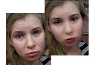 Отретуширую фотографию. Устраню дефекты лица и фона